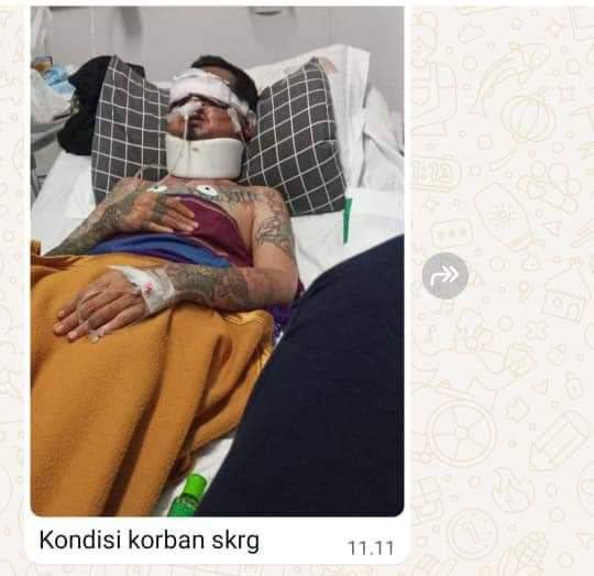 Acara komunitas Vespa yang seharusnya menjadi ajang silaturahmi kini berubah menjadi tragedi mengerikan di Gunung Putri, Bogor, Berujung Pencongkelan Kedua Mata