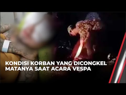 Insiden Tragis di Acara Vespa: Pelaku Congkel Mata Korban