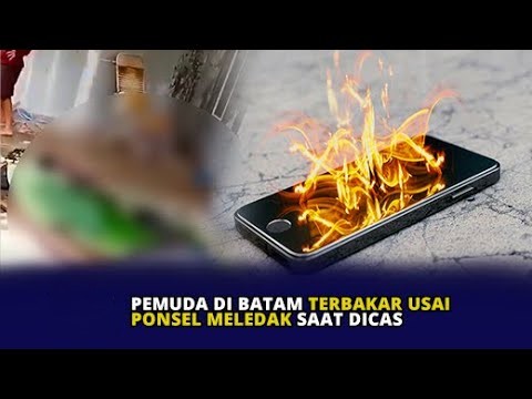 Viral! Pemuda Batam Terbakar Setelah Ponsel Meledak Saat Tidur